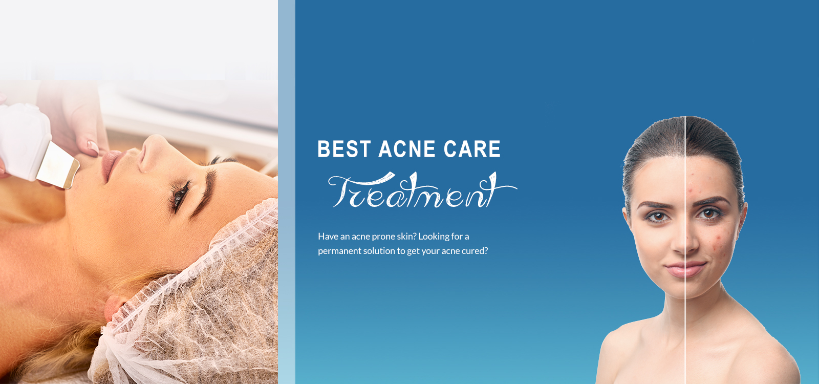 Best Cosmetic Clinic in India