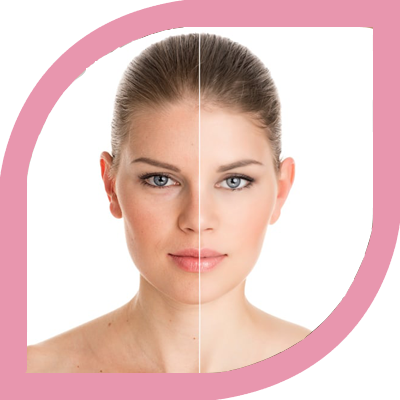 Electrocautery & Radiocautery