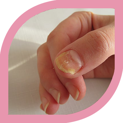 Electrocautery & Radiocautery