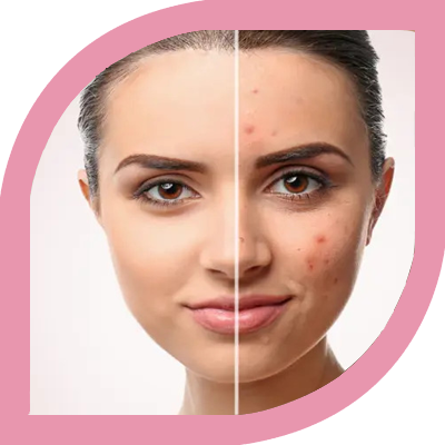 Electrocautery & Radiocautery